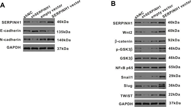 Western blot - Anti-Hsp47 antibody [EPR4217] (AB109117)