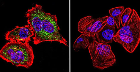 Immunocytochemistry/ Immunofluorescence - Anti-Hsp60 antibody [2E1/53] - Mitochondrial Marker (AB5479)