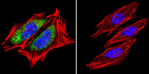 Immunocytochemistry/ Immunofluorescence - Anti-Hsp60 antibody [4B9/89] (AB5478), expandable thumbnail