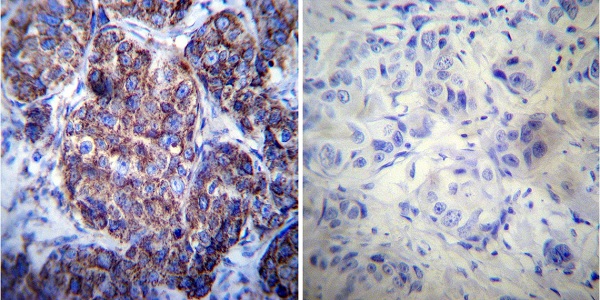 Immunohistochemistry (Formalin/PFA-fixed paraffin-embedded sections) - Anti-Hsp60 antibody [4B9/89] (ab5478), expandable thumbnail