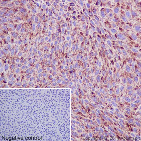 Immunohistochemistry (Formalin/PFA-fixed paraffin-embedded sections) - Anti-Hsp60 antibody [EP1006Y] - BSA and Azide free (AB239835)