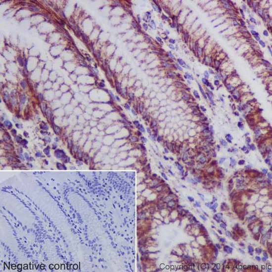 Immunohistochemistry (Formalin/PFA-fixed paraffin-embedded sections) - Anti-Hsp60 antibody [EP1006Y] - BSA and Azide free (AB239835)