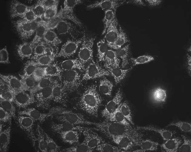 Immunocytochemistry/ Immunofluorescence - Anti-Hsp60 antibody [LK-1] (ab59457), expandable thumbnail