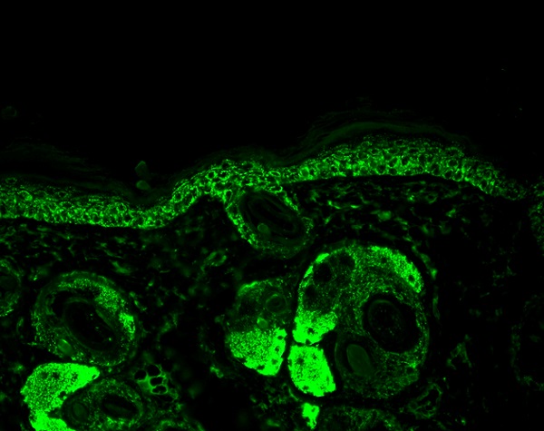 Immunohistochemistry (Formalin/PFA-fixed paraffin-embedded sections) - Anti-Hsp60 antibody [LK-2] (AB59458), expandable thumbnail