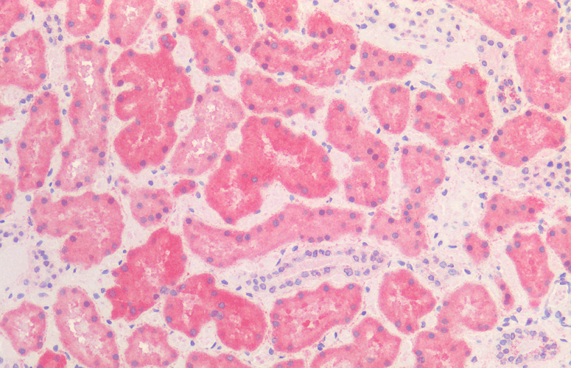 Immunohistochemistry (Formalin/PFA-fixed paraffin-embedded sections) - Anti-Hsp60 antibody [LK-2] (AB59458), expandable thumbnail
