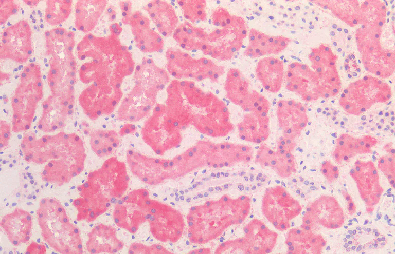 Immunohistochemistry (Formalin/PFA-fixed paraffin-embedded sections) - Anti-Hsp60 antibody [LK-2] - Mitochondrial Marker (AB59458)