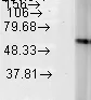 Western blot - Anti-Hsp60 antibody [LK-2] - Mitochondrial Marker (AB59458)