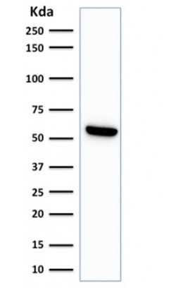 Western blot - Anti-Hsp60 antibody [LK1] - Mitochondrial Marker (AB233878), expandable thumbnail