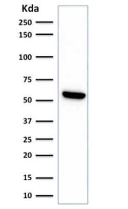Western blot - Anti-Hsp60 antibody [LK1] - Mitochondrial Marker (AB233878)