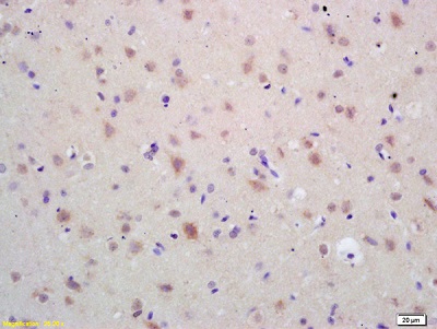 Immunohistochemistry (Formalin/PFA-fixed paraffin-embedded sections) - Anti-Hsp60 antibody (AB216634), expandable thumbnail