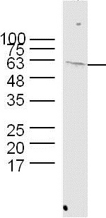 Western blot - Anti-Hsp60 antibody - Mitochondrial Marker (AB216634), expandable thumbnail