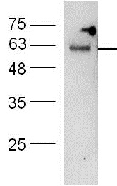Western blot - Anti-Hsp60 antibody - Mitochondrial Marker (ab216634), expandable thumbnail