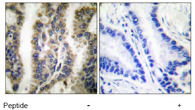 Immunohistochemistry (Formalin/PFA-fixed paraffin-embedded sections) - Anti-Hsp60 antibody (AB53109), expandable thumbnail
