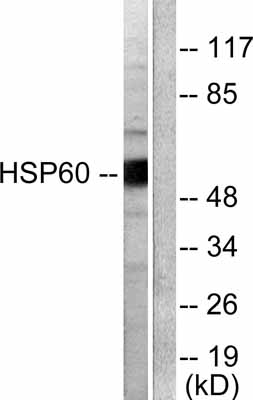 Western blot - Anti-Hsp60 antibody - Mitochondrial Marker (AB53109), expandable thumbnail