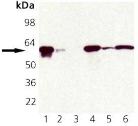 Western blot - Anti-Hsp60 antibody - Mitochondrial Marker (AB82520), expandable thumbnail