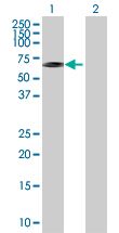 Western blot - Hsp60 overexpression 293T lysate (whole cell) (AB94126)