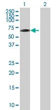 Western blot - Hsp60 overexpression 293T lysate (whole cell) (AB94126)