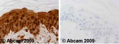 Immunohistochemistry (Formalin/PFA-fixed paraffin-embedded sections) - Anti-Hsp70 antibody [2A4] (ab5442), expandable thumbnail