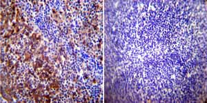 Immunohistochemistry (Formalin/PFA-fixed paraffin-embedded sections) - Anti-Hsp70 antibody [2A4] (ab5442), expandable thumbnail