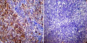 Immunohistochemistry (Formalin/PFA-fixed paraffin-embedded sections) - Anti-Hsp70 antibody [2A4] (AB5442)