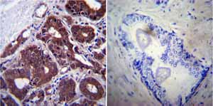 Immunohistochemistry (Formalin/PFA-fixed paraffin-embedded sections) - Anti-Hsp70 antibody [2A4] (ab5442), expandable thumbnail