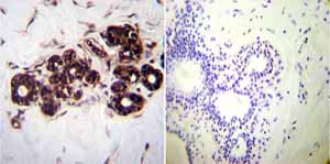 Immunohistochemistry (Formalin/PFA-fixed paraffin-embedded sections) - Anti-Hsp70 antibody [2A4] (ab5442), expandable thumbnail