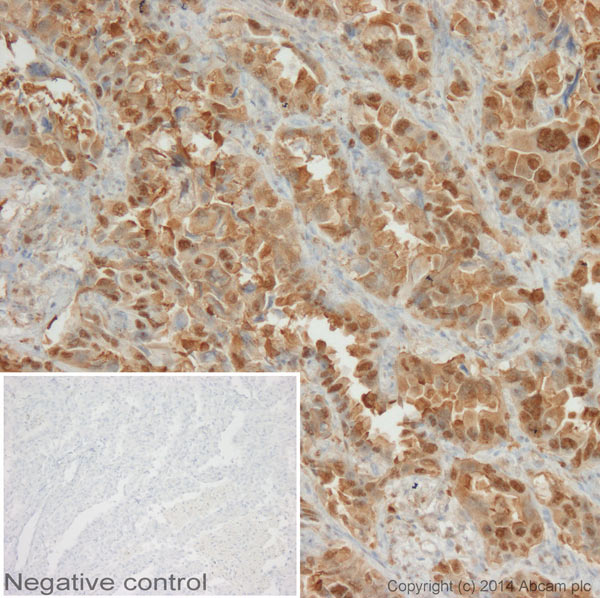Immunohistochemistry (Formalin/PFA-fixed paraffin-embedded sections) - Anti-Hsp70 antibody [2A4] (AB5442), expandable thumbnail
