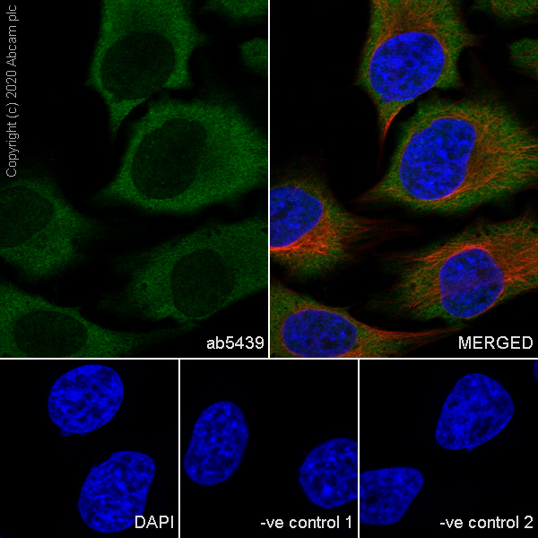 Immunocytochemistry/ Immunofluorescence - Anti-Hsp70 antibody [3A3] - BSA and Azide free (AB252240), expandable thumbnail