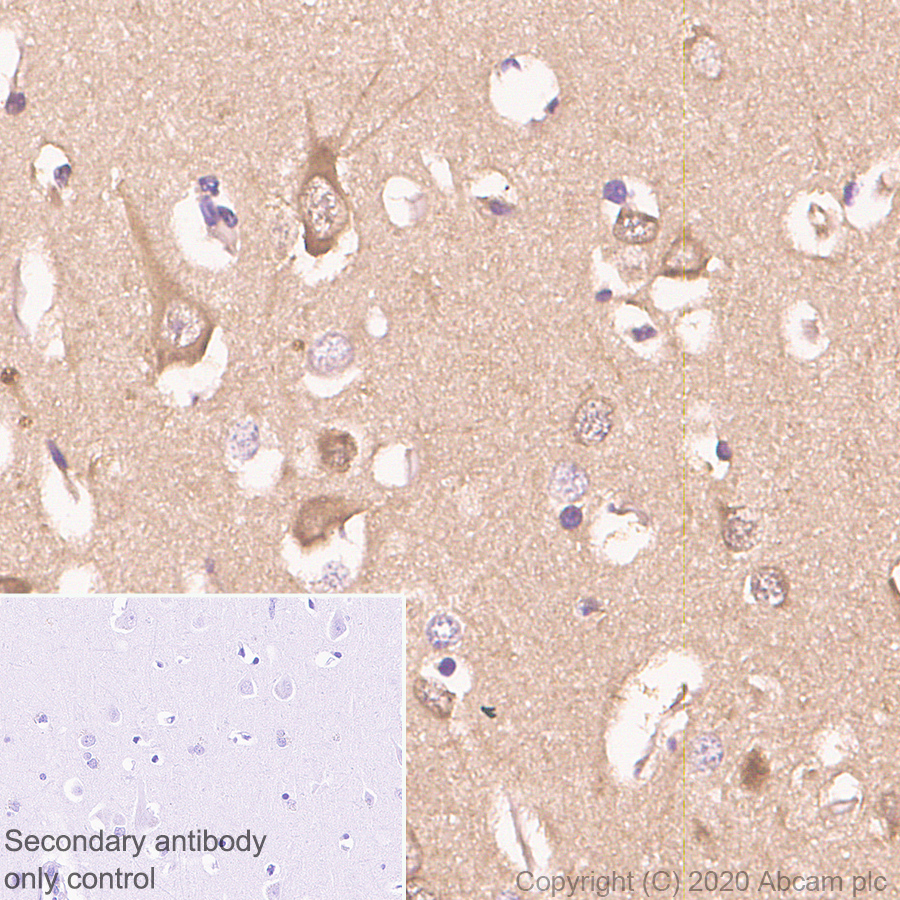 Immunohistochemistry (Formalin/PFA-fixed paraffin-embedded sections) - Anti-Hsp70 antibody [3A3] - BSA and Azide free (AB252240), expandable thumbnail