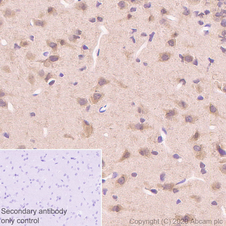 Immunohistochemistry (Formalin/PFA-fixed paraffin-embedded sections) - Anti-Hsp70 antibody [3A3] - BSA and Azide free (ab252240), expandable thumbnail
