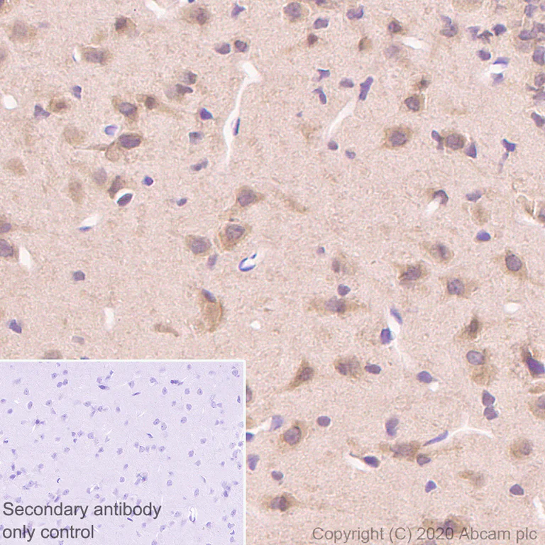 Immunohistochemistry (Formalin/PFA-fixed paraffin-embedded sections) - Anti-Hsp70 antibody [3A3] - BSA and Azide free (AB252240)