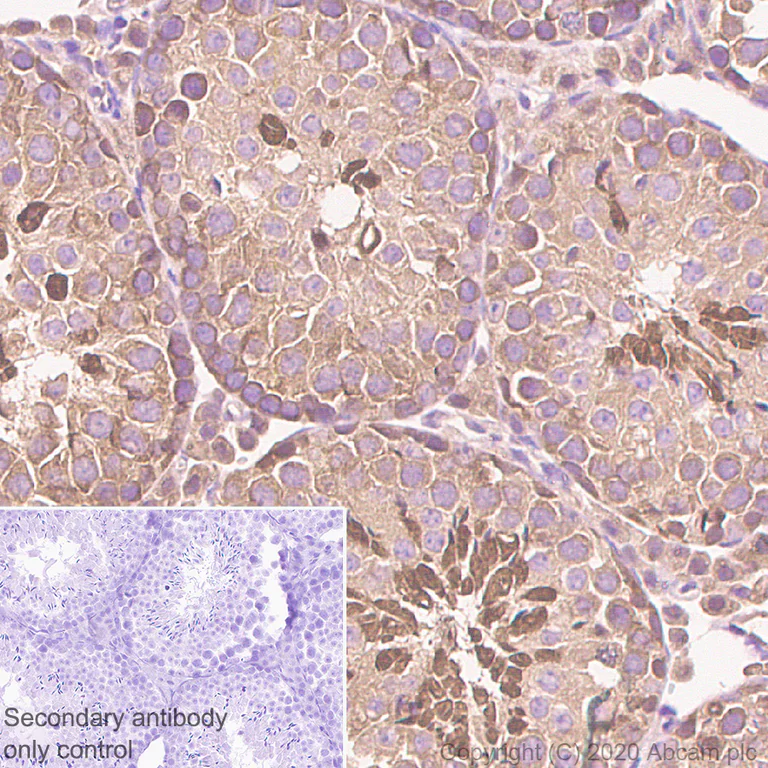 Immunohistochemistry (Formalin/PFA-fixed paraffin-embedded sections) - Anti-Hsp70 antibody [3A3] - BSA and Azide free (AB252240)