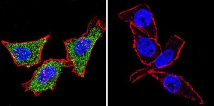 Immunocytochemistry/ Immunofluorescence - Anti-Hsp70 antibody [5A5] (ab2787), expandable thumbnail