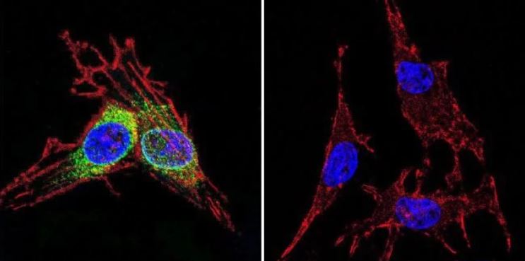 Immunocytochemistry/ Immunofluorescence - Anti-Hsp70 antibody [5A5] (ab2787), expandable thumbnail
