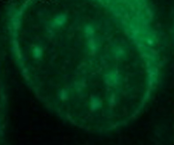 Immunocytochemistry/ Immunofluorescence - Anti-Hsp70 antibody [5A5] (AB2787), expandable thumbnail