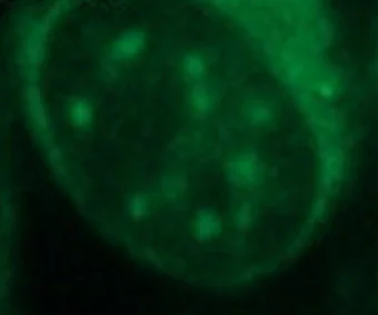 Immunocytochemistry/ Immunofluorescence - Anti-Hsp70 antibody [5A5] (AB2787)