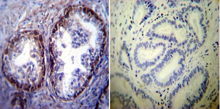Immunohistochemistry (Formalin/PFA-fixed paraffin-embedded sections) - Anti-Hsp70 antibody [5A5] (ab2787), expandable thumbnail