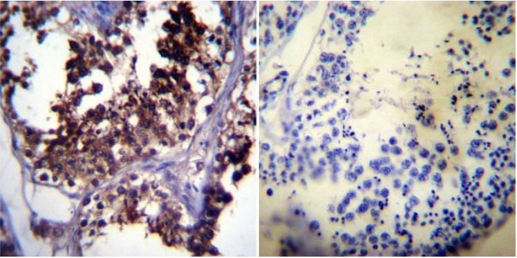 Immunohistochemistry (Formalin/PFA-fixed paraffin-embedded sections) - Anti-Hsp70 antibody [5A5] (ab2787), expandable thumbnail