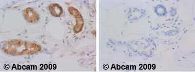 Immunohistochemistry (Formalin/PFA-fixed paraffin-embedded sections) - Anti-Hsp70 antibody [5A5] (AB2787)