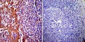 Immunohistochemistry (Formalin/PFA-fixed paraffin-embedded sections) - Anti-Hsp70 antibody [5A5] (ab2787), expandable thumbnail