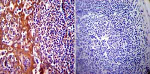 Immunohistochemistry (Formalin/PFA-fixed paraffin-embedded sections) - Anti-Hsp70 antibody [5A5] (AB2787)