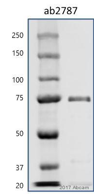 Western blot - Anti-Hsp70 antibody [5A5] (ab2787), expandable thumbnail