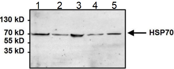 Western blot - Anti-Hsp70 antibody [5A5] (ab2787), expandable thumbnail