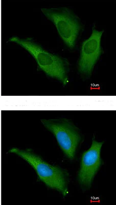 Immunocytochemistry/ Immunofluorescence - Anti-Hsp70 antibody (AB137680)