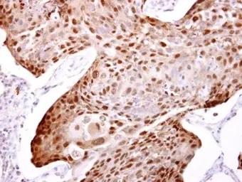 Immunohistochemistry (Formalin/PFA-fixed paraffin-embedded sections) - Anti-Hsp70 antibody (AB137680)