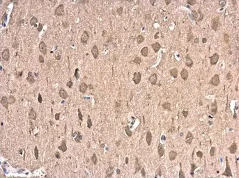 Immunohistochemistry (Formalin/PFA-fixed paraffin-embedded sections) - Anti-Hsp70 antibody (AB137680)