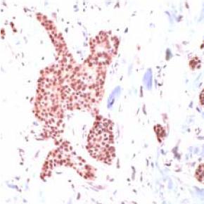 Immunohistochemistry (Formalin/PFA-fixed paraffin-embedded sections) - Anti-Hsp70 antibody (AB31010)