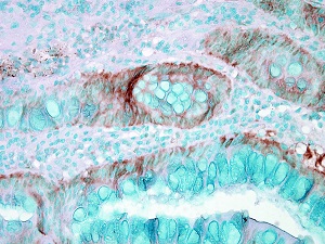 Immunohistochemistry (Formalin/PFA-fixed paraffin-embedded sections) - Anti-Hsp70 antibody (AB79852), expandable thumbnail