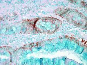 Immunohistochemistry (Formalin/PFA-fixed paraffin-embedded sections) - Anti-Hsp70 antibody (AB79852)