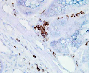 Immunohistochemistry (Formalin/PFA-fixed paraffin-embedded sections) - Anti-Hsp70 antibody [BB70] (AB53496)